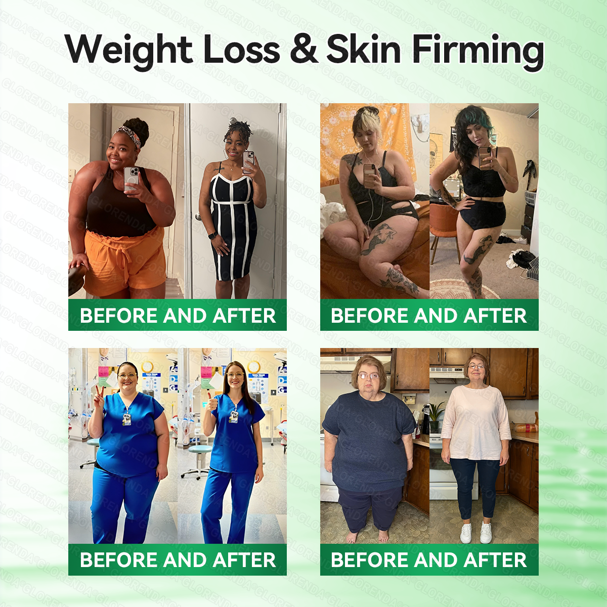 🇺🇸𝑶𝒇𝒇𝒊𝒄𝒊𝒂𝒍 𝑺𝒕𝒐𝒓𝒆 | 👩‍⚕️𝐂𝐚𝐫𝐞𝐔𝐩𝐥𝐢𝐟𝐭®𝑴𝒐𝒓𝒊𝒏𝒈𝗮 · 𝗕𝗲𝗿𝗯𝗲𝗿𝙞𝙣𝙚 × 𝙉𝘼𝐃+ 𝟏𝟎-𝐢𝐧-𝟏 𝗔𝗱𝘃𝗮𝗻𝗰𝙚𝙙 𝙉𝙖𝙣𝙤 𝙈𝙞𝙘𝙧𝙤𝙣𝙚𝙚𝐝𝐥𝐞 𝐏𝐚𝐭𝙘𝙝🇺🇸(𝐉𝐮𝐬𝐭 𝐨𝐧𝐜𝐞 𝐚 𝐝𝐚𝐲, 𝐯𝐢𝐬𝐢𝐛𝐥𝐞 𝐜𝐡𝐚𝐧𝐠𝐞𝐬 𝐢𝐧 𝟕 𝐝𝐚𝐲𝐬） ✅ 𝐅𝐨𝐫 𝐨𝐛𝐞𝐬𝐢𝐭𝐲, 🅛🅞🅞🅢🅔 🅢🅚🅘🅝,𝐝𝐢𝐚𝐛𝐞𝐭𝐞𝐬, 𝐬𝐥𝐞𝐞𝐩 𝐚𝐩𝐧𝐞𝐚, 𝐣𝐨𝐢𝐧𝐭 𝐢𝐬𝐬𝐮𝐞𝐬, 𝐚𝐧𝐝 𝐦𝐨𝐫𝐞💯💯