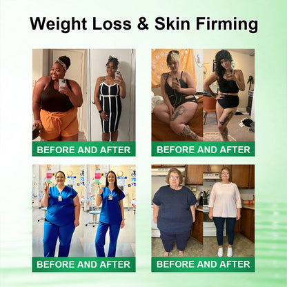 𝐂𝐚𝐫𝐞𝐔𝐩𝐥𝐢𝐟𝐭® 𝑴𝒆𝒕𝒂𝒃𝒐𝒍𝒊𝒄 𝑵𝒂𝒏𝒐 𝑴𝒊𝒄𝒓𝒐𝒏𝒆𝒆𝒅𝒍𝒆 𝑷𝒂𝒕𝒄𝒉🇺🇸(𝐉𝐮𝐬𝐭 𝐨𝐧𝐜𝐞 𝐚 𝐝𝐚𝐲, 𝐯𝐢𝐬𝐢𝐛𝐥𝐞 𝐜𝐡𝐚𝐧𝐠𝐞𝐬 𝐢𝐧 𝟕 𝐝𝐚𝐲𝐬）𝘽𝙚𝙧𝙗𝙚𝙧𝙞𝙣𝙚 + 𝙈𝙤𝙧𝙞𝙣𝙜𝙖 𝙁𝙤𝙧𝙢𝙪𝙡𝙖 ✅ 𝐅𝐨𝐫 𝐨𝐛𝐞𝐬𝐢𝐭𝐲, 𝗟𝗼𝗼𝘀𝗲 𝘀𝗸𝗶𝗻,𝐝𝐢𝐚𝐛𝐞𝐭𝐞𝐬, 𝐬𝐥𝐞𝐞𝐩 𝐚𝐩𝐧𝐞𝐚, 𝐣𝐨𝐢𝐧𝐭 𝐢𝐬𝐬𝐮𝐞𝐬, 𝐚𝐧𝐝 𝐦𝐨𝐫𝐞 💯💯